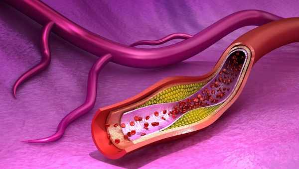 Очищення крові від холестерину