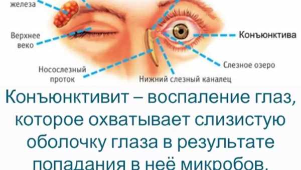 Смикається ліве або праве око у дорослого і дитини (нижнє або верхнє століття) - причини і способи лікування; текстова та відео інструкція