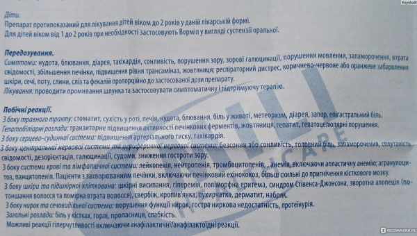 Чому сильно випадають ресниці і що з цим робити? - народні кошти для лікування; текстова та відео інструкція