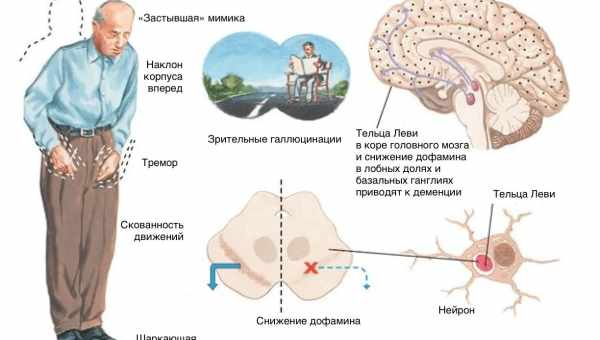 Нейромережа навчилася визначати вік мозку за МРТ